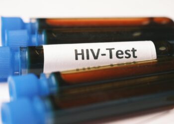 Βραζιλία: Ασθενείς προσβλήθηκαν από τον HIV μετά από μεταμόσχευση οργάνων