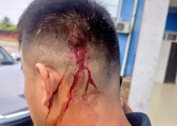 Σοκαριστικά βίντεο από την απόπειρα δολοφονίας κατά του πρώην προέδρου της Βολιβίας (video, photo)