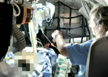 Έτσι έγινε η μεταμόσχευση ήπατος στον Δημήτρη – Τι λέει ο Ιταλός χειρουργός για την ανιδρωσία