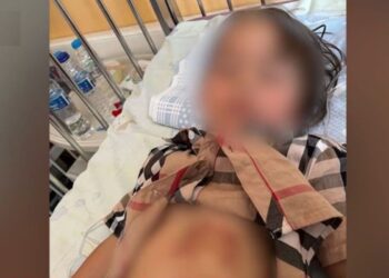 Χαλκιδική: Σοκάρουν τα τραύματα της μικρής που δαγκώθηκε από λύκο