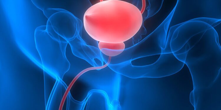 Ουρολοίμωξη: 2η στις λοιμώξεις στην Ευρώπη