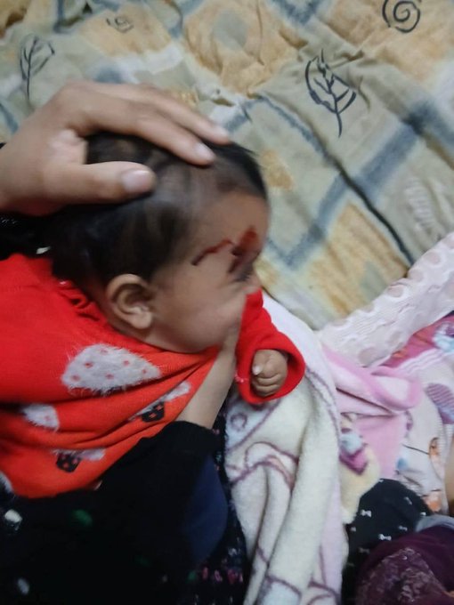 Δυτική Όχθη: Eπίθεση εποίκων σε σπίτι Παλαιστινίων – Τραυματίστηκε βρέφος οκτώ μηνών