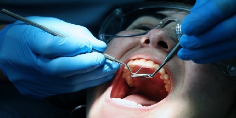 Πώς συνδέεται η ουλίτιδα με αυξημένο κίνδυνο σοβαρών καρδιαγγειακών επεισοδίων