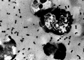 Όταν ένα ηφαίστειο ξεκίνησε τη «Μαύρη Πανώλη»: Η κλιματική αλυσίδα που άλλαξε τον κόσμο