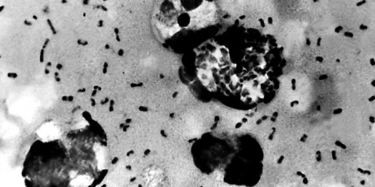 Όταν ένα ηφαίστειο ξεκίνησε τη «Μαύρη Πανώλη»: Η κλιματική αλυσίδα που άλλαξε τον κόσμο