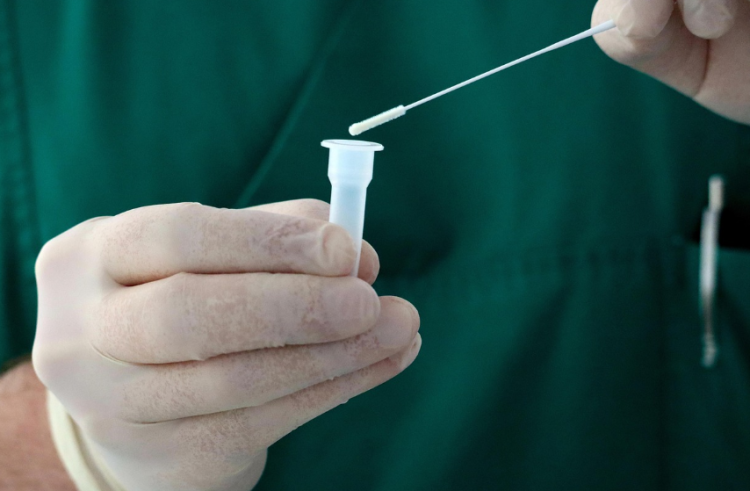 Covid – Γρίπη: Πλαστά τεστ κυκλοφορούν στην αγορά – Πανευρωπαϊκός συναγερμός