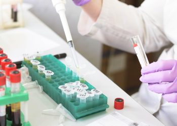 Η χαμηλή τεστοστερόνη στους άνδρες συνδέεται με αυξημένο κίνδυνο πρόωρου θανάτου