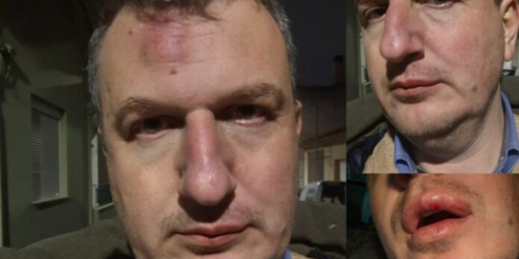 Θύμα ξυλοδαρμού έπεσε ο εκδότης Δημήτρης Καρεκλίδης στον Βόλο